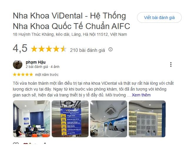 Hình: review trồng răng implant ViDental
